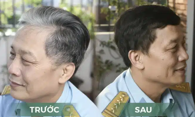 Dầu gội thảo dược thiên nhiên có tốt không?