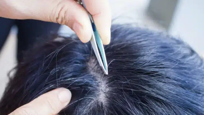 Tác hại của việc nhổ tóc bạc và cách chăm sóc tóc bạc đúng cách